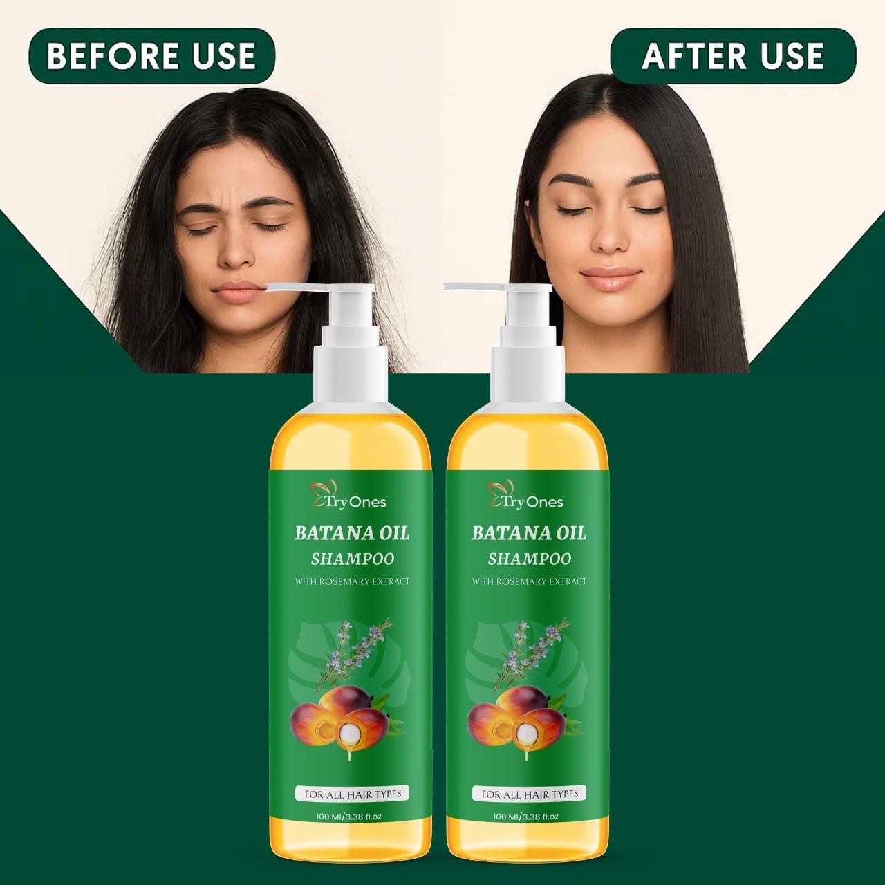 BATANA OIL SHAMPOO with Rosemary Extract (buy 1 get 1 free)